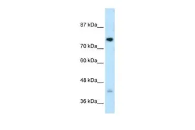 Anti-DCST1 antibody, C-term used in Western Blot (WB). GTX46888