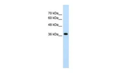 Anti-LONRF1 antibody, N-term used in Western Blot (WB). GTX46891