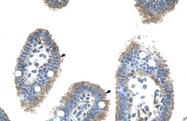 Anti-UBE2J2 antibody, C-term used in IHC (Paraffin sections) (IHC-P). GTX46897