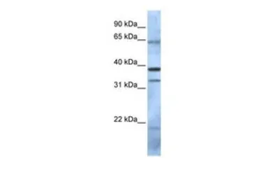 Anti-PCGF5 antibody, N-term used in Western Blot (WB). GTX46899