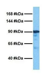 Anti-FBXO11 antibody, Internal used in Western Blot (WB). GTX46904