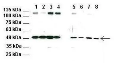 Anti-RNF128 antibody, C-term used in Western Blot (WB). GTX46906