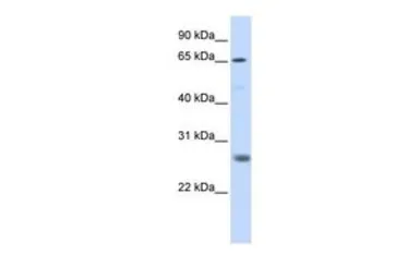 Anti-RNF186 antibody, N-term used in Western Blot (WB). GTX46911
