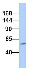 Anti-RC3H2 antibody, Internal used in Western Blot (WB). GTX46912