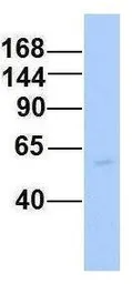 Anti-RC3H2 antibody, Internal used in Western Blot (WB). GTX46912