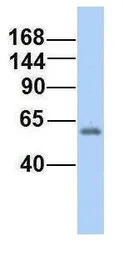 Anti-RC3H2 antibody, Internal used in Western Blot (WB). GTX46912