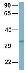 Anti-RNF126 antibody, N-term used in Western Blot (WB). GTX46914