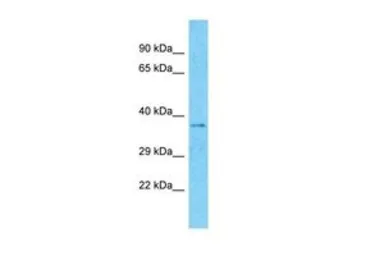Anti-MARCH5 antibody, N-term used in Western Blot (WB). GTX46916