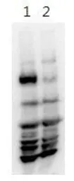 Anti-HERC5 antibody, Internal used in Western Blot (WB). GTX46920