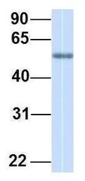 Anti-EMI1 antibody, C-term used in Western Blot (WB). GTX46926
