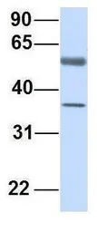 Anti-EMI1 antibody, C-term used in Western Blot (WB). GTX46926