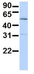 Anti-FBXO3 antibody, N-term used in Western Blot (WB). GTX46928