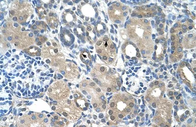 Anti-FBXO25 antibody, C-term used in IHC (Paraffin sections) (IHC-P). GTX46929