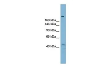 Anti-RBBP6 antibody, N-term used in Western Blot (WB). GTX46931