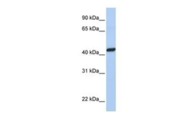 Anti-PEX10 antibody, C-term used in Western Blot (WB). GTX46940