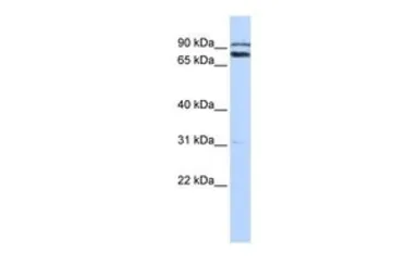 Anti-TRIM67 antibody, C-term used in Western Blot (WB). GTX46943