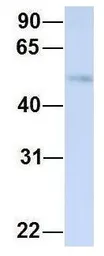 Anti-TJAP1 antibody, N-term used in Western Blot (WB). GTX46946