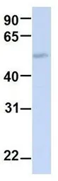 Anti-TJAP1 antibody, N-term used in Western Blot (WB). GTX46946
