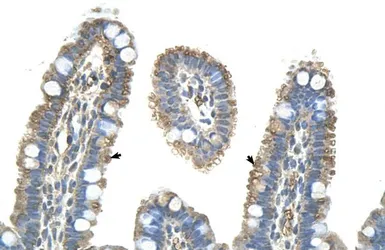 Anti-Pannexin 1 antibody, Internal used in IHC (Paraffin sections) (IHC-P). GTX46955
