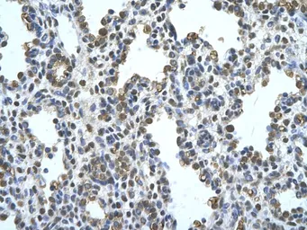 Anti-Pannexin 1 antibody, Internal used in IHC (Paraffin sections) (IHC-P). GTX46955