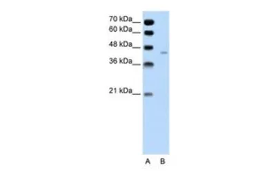 Anti-Pannexin 1 antibody, Internal used in Western Blot (WB). GTX46955