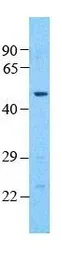 Anti-Pannexin 1 antibody, Internal used in Western Blot (WB). GTX46955