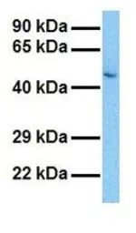 Anti-Pannexin 1 antibody, Internal used in Western Blot (WB). GTX46955