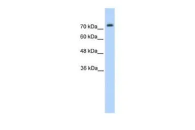 Anti-PANX2 antibody, N-term used in Western Blot (WB). GTX46957