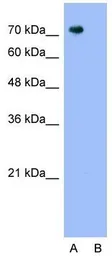 Anti-PANX2 antibody, N-term used in Western Blot (WB). GTX46957