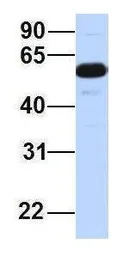 Anti-ZGPAT antibody, Internal used in Western Blot (WB). GTX46963