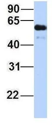 Anti-ZGPAT antibody, Internal used in Western Blot (WB). GTX46963