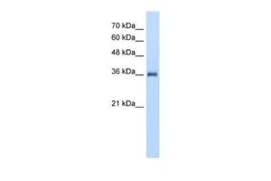 Anti-PPAP2A antibody, N-term used in Western Blot (WB). GTX46964