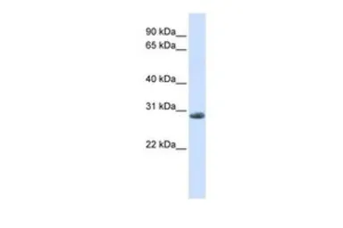 Anti-YIPF6 antibody, C-term used in Western Blot (WB). GTX46966