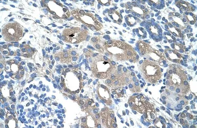 Anti-RSAD2 antibody, C-term used in IHC (Paraffin sections) (IHC-P). GTX46969