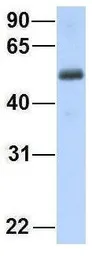 Anti-ZGPAT antibody, C-term used in Western Blot (WB). GTX46974