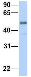 Anti-ZGPAT antibody, C-term used in Western Blot (WB). GTX46974