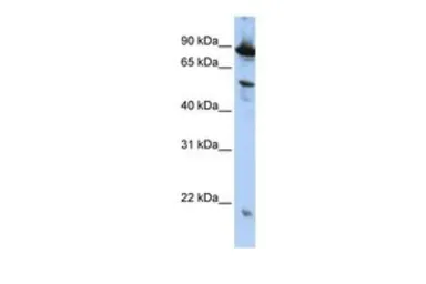 Anti-ZGPAT antibody, N-term used in Western Blot (WB). GTX46975