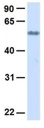 Anti-SLC19A3 antibody, Internal used in Western Blot (WB). GTX46980