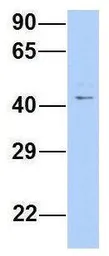 Anti-TRABD antibody, Internal used in Western Blot (WB). GTX46982