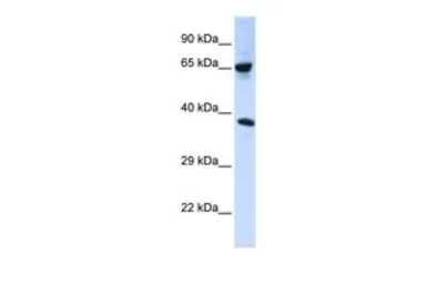 Anti-C6ORF134 antibody, Internal used in Western Blot (WB). GTX46984