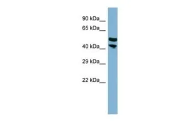 Anti-Protor-2 antibody, Internal used in Western Blot (WB). GTX46987