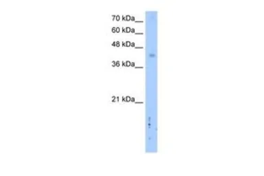 Anti-LRRC2 antibody, C-term used in Western Blot (WB). GTX46990