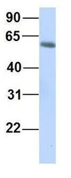 Anti-GTPBP2 antibody, N-term used in Western Blot (WB). GTX46998