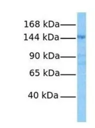 Anti-KIAA1199 antibody, Internal used in Western Blot (WB). GTX47001