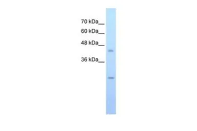 Anti-FLJ20489 antibody, C-term used in Western Blot (WB). GTX47007