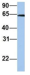 Anti-EPS8L1 antibody, Internal used in Western Blot (WB). GTX47008