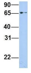 Anti-EPS8L1 antibody, Internal used in Western Blot (WB). GTX47008