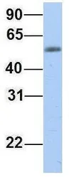 Anti-EPS8L1 antibody, Internal used in Western Blot (WB). GTX47008