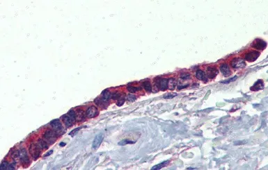 Anti-PLUNC antibody, Internal used in IHC (Paraffin sections) (IHC-P). GTX47015