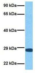 Anti-PLUNC antibody, Internal used in Western Blot (WB). GTX47015